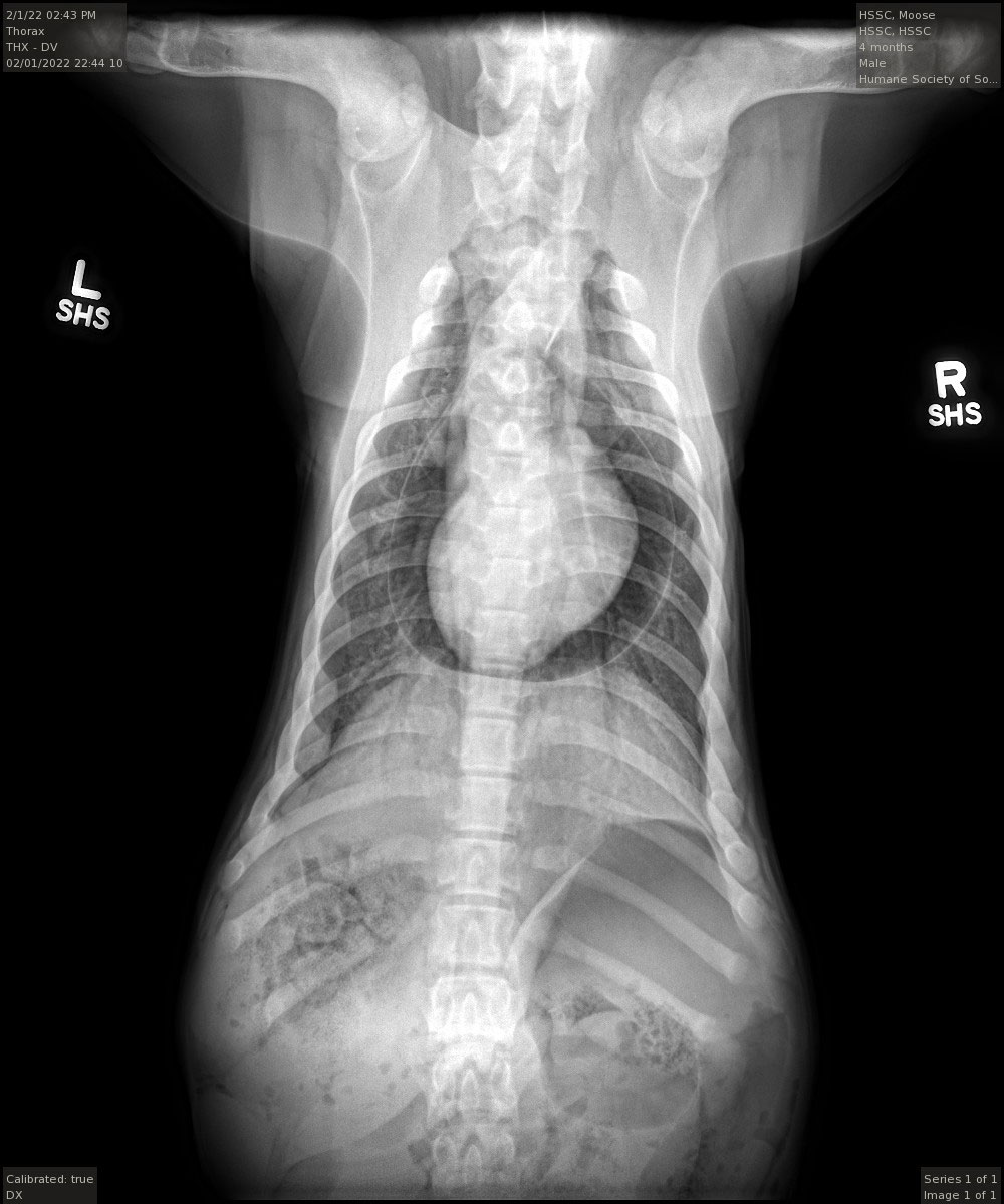 X-rays of Kodak's chest